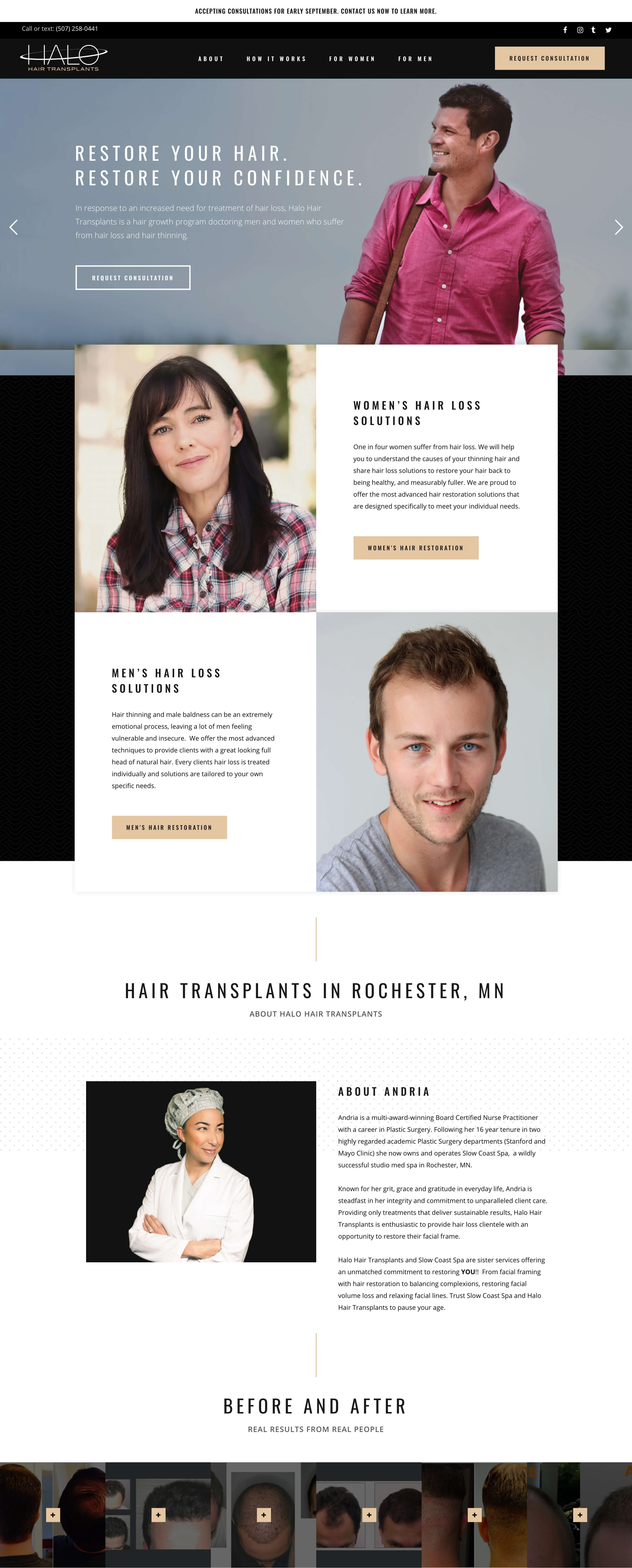 Halo Hair Transplants WP Codeus