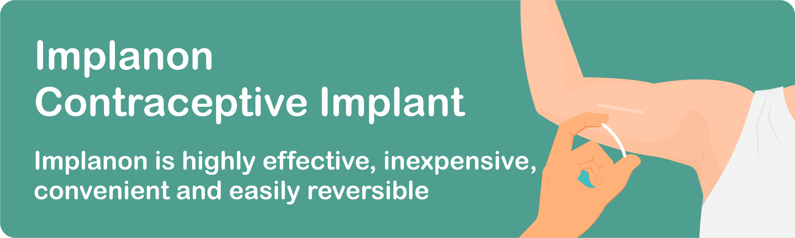 Implanon contraceptive implant General Practitioners Ringwood