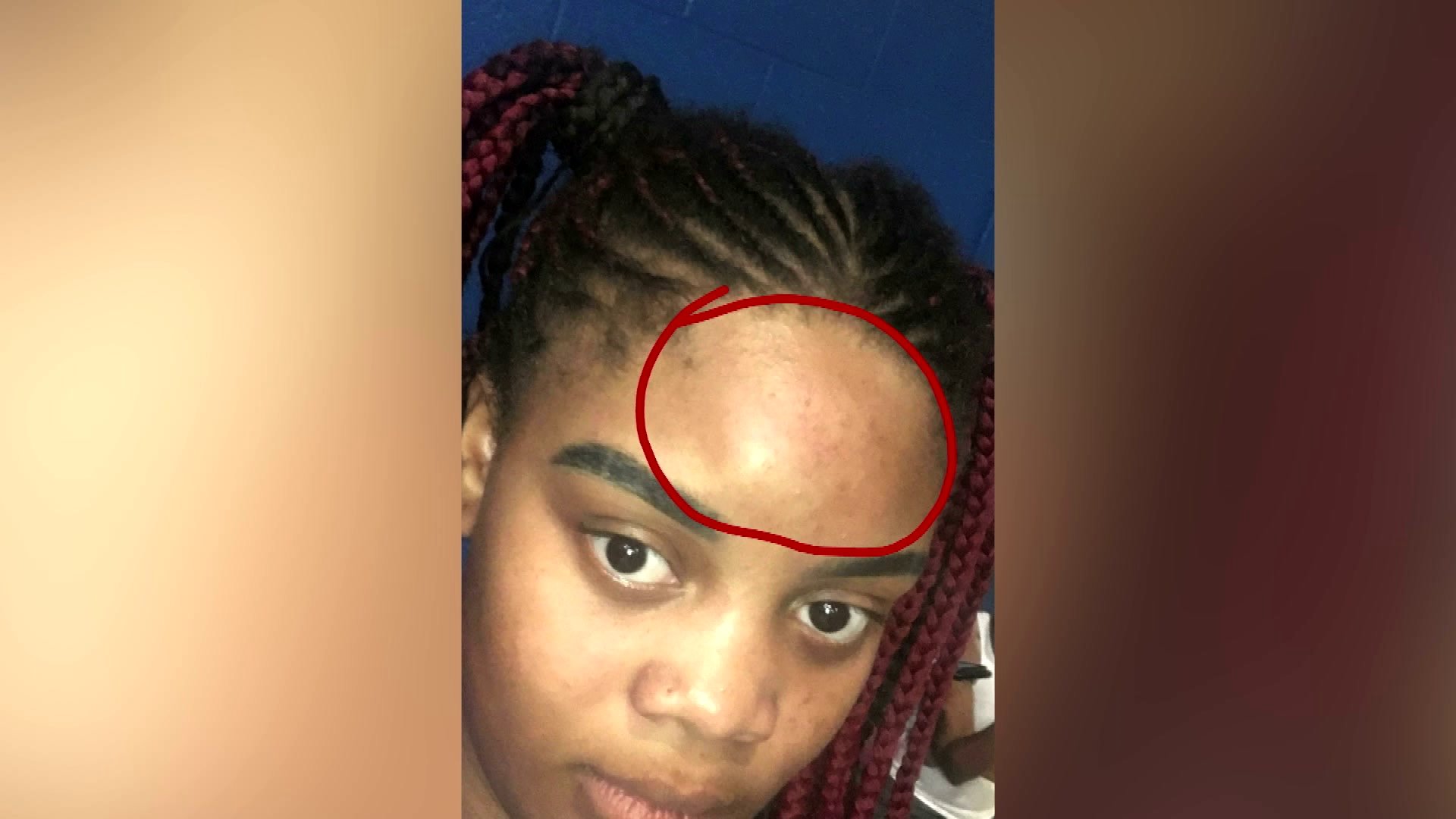 High school volleyball team attacked by rival team after game