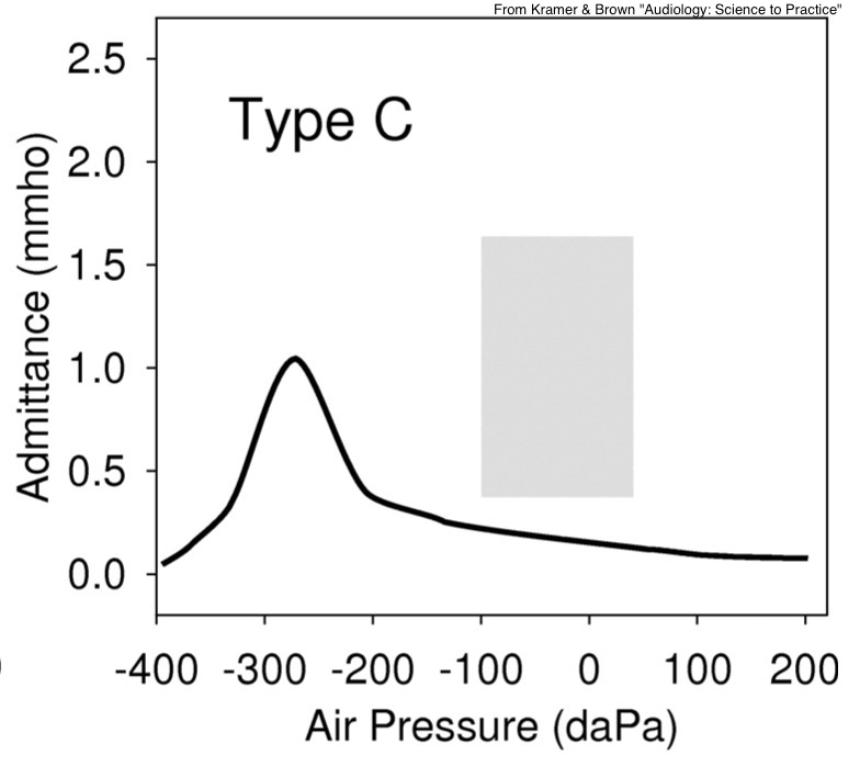 Tympanograms provide valuable information!