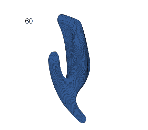 LESA Longitudinal Elastic Shape Analysis of Brain Subcortical