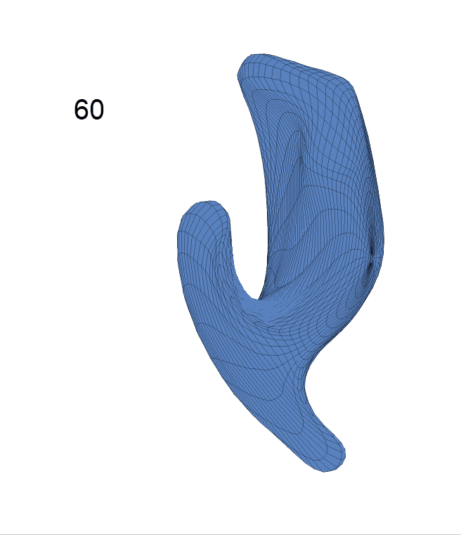 LESA Longitudinal Elastic Shape Analysis of Brain Subcortical