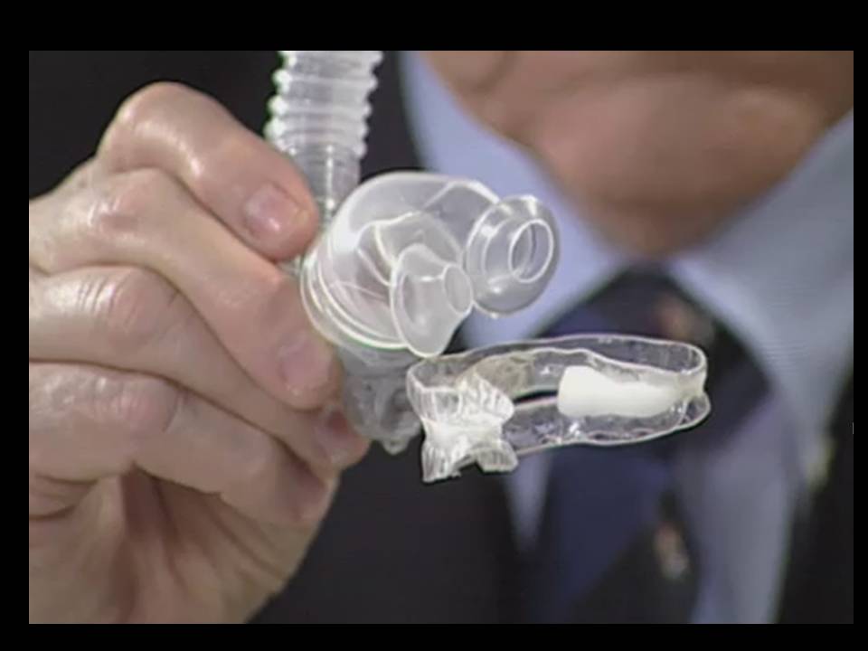 Dental devices for sleep apnea treatment