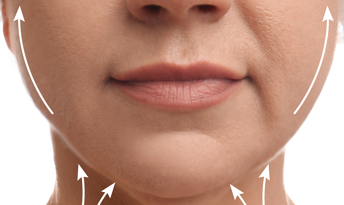 What is Ozempic Face? The Effect Caused by the Weight Loss Medication WWD