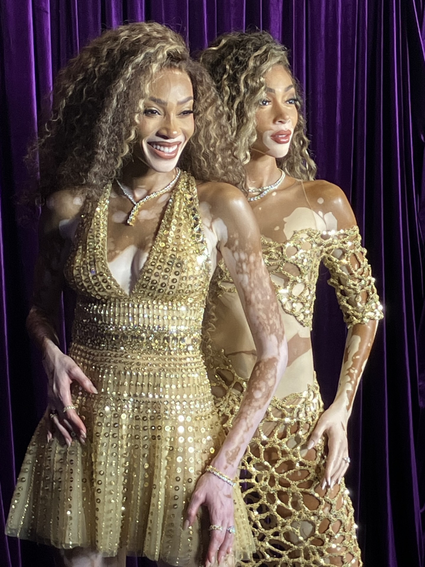 Winnie Harlow Wax Figure Unveiled at Madame Tussauds Times Square