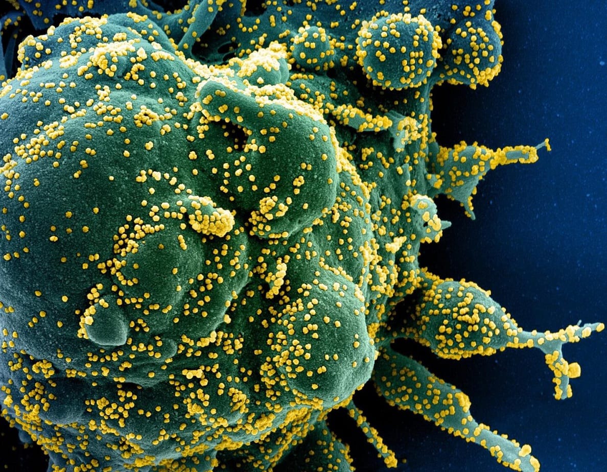 Bad News Delta Variant Now Dominant Coronavirus Strain in U.S