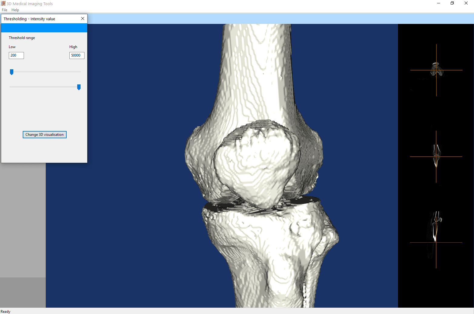3D Medical Imaging Tools Download Free medical / NIfTI / STL