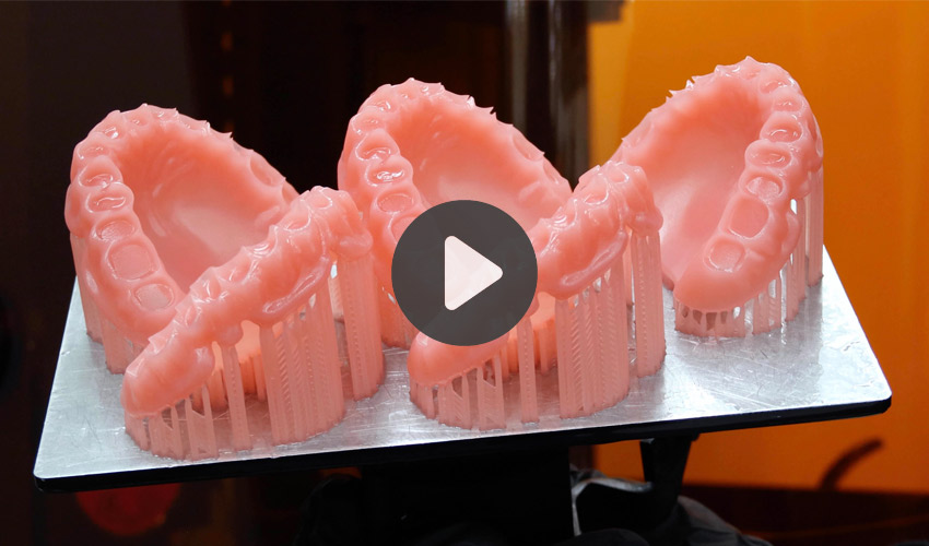 TOP 5 Videos How to Print and PostProcess Dental Models 3Dnatives