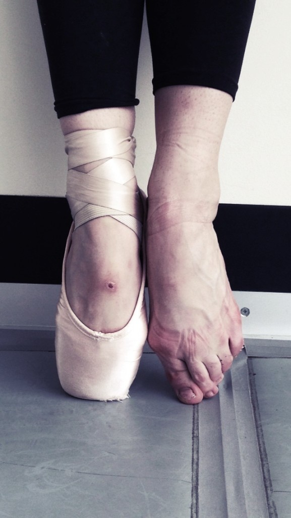 Ribbons, Ice, Everything Painful and Nice A Pro Dancer