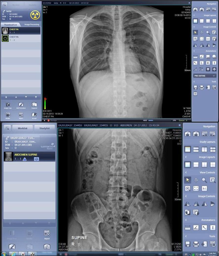 Rayence Viewing Software A D Imaging