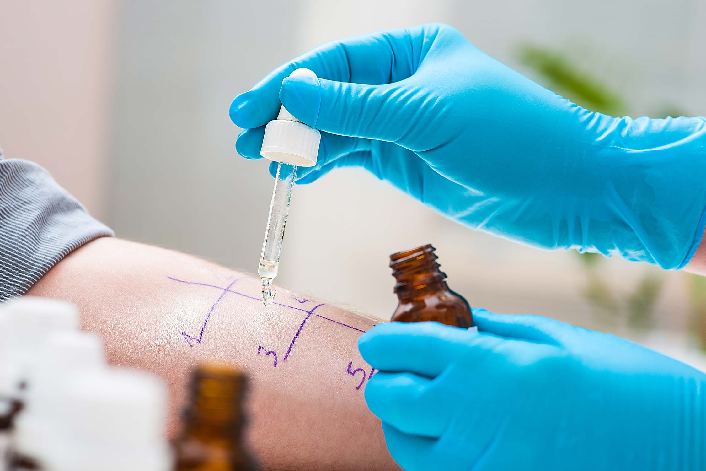 Allergy Testing Allergy and Asthma Center of Texas