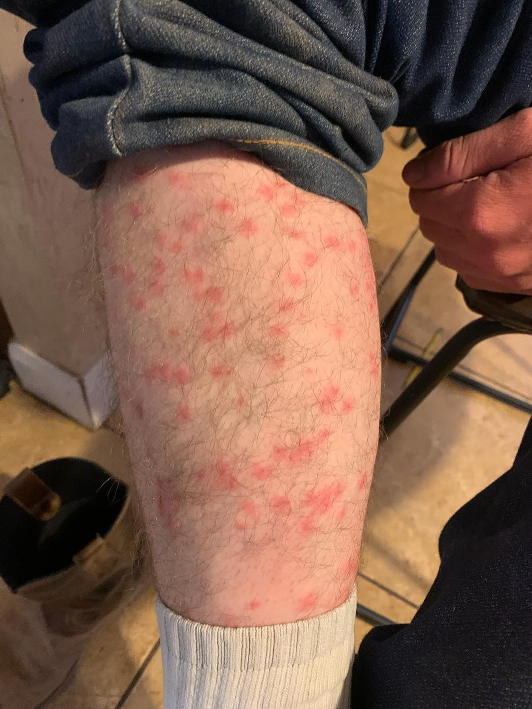 Watch out for swimmer’s itch at Sand Hollow ABC4 Utah