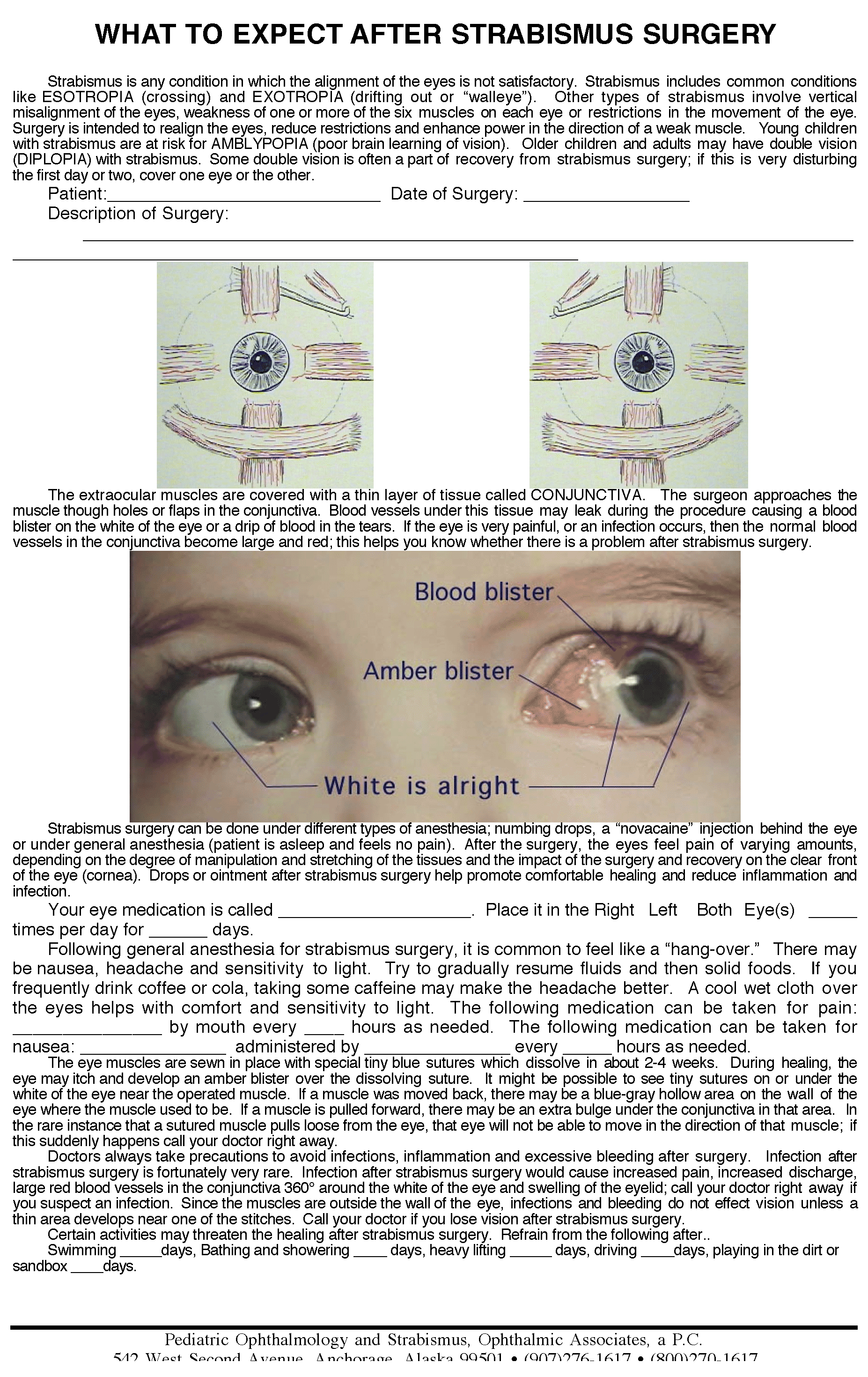 Strabismus PostOp