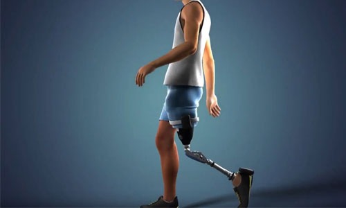 Une nouvelle prothèse pour membre amputé Access Market