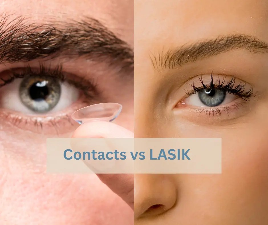 LongTerm Safety of LASIK Vs Contact Lenses AccuVision The Eye Clinic