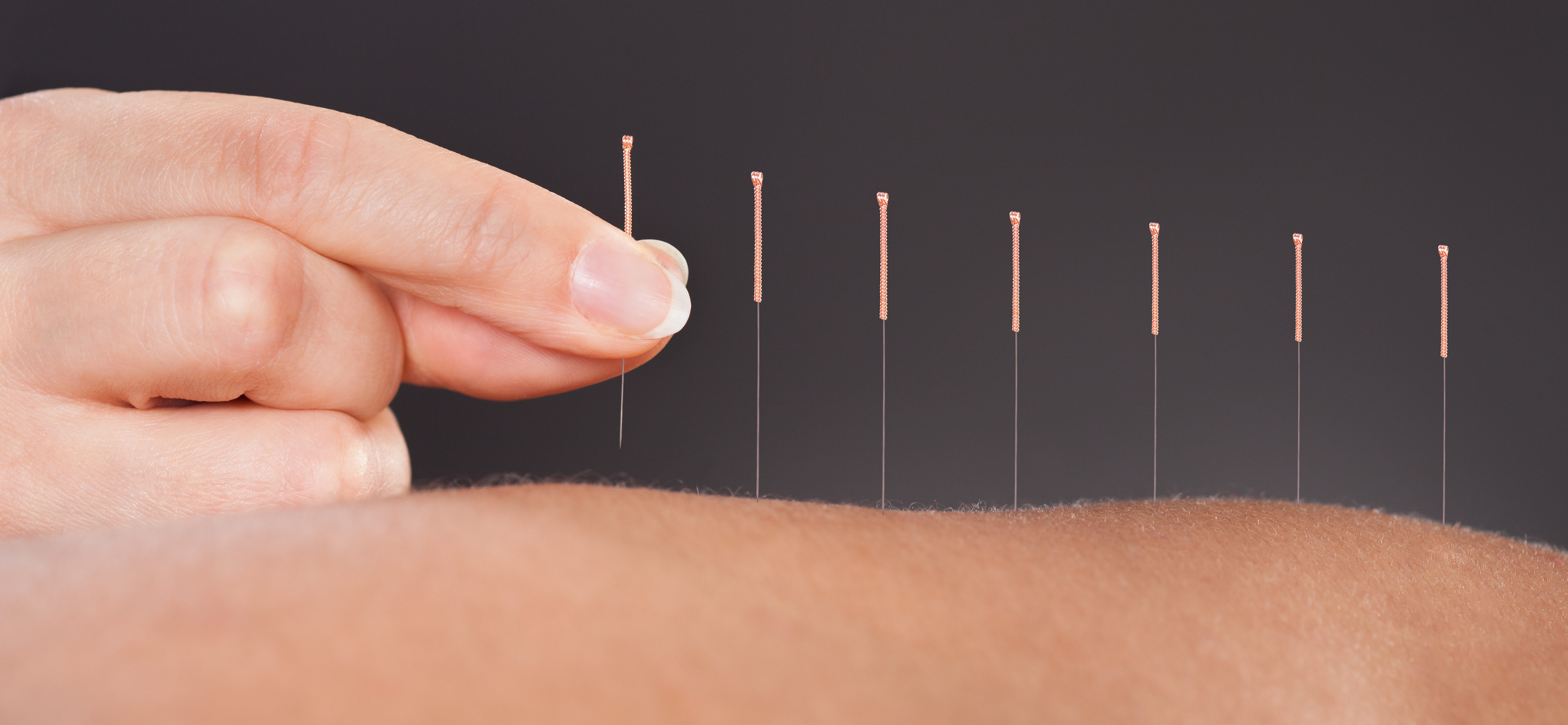 Some Of The Principles Believed To Be Behind The Success Of Acupuncture
