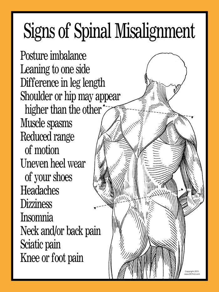 Signs of Spinal Misalignment Poster 18 x 24