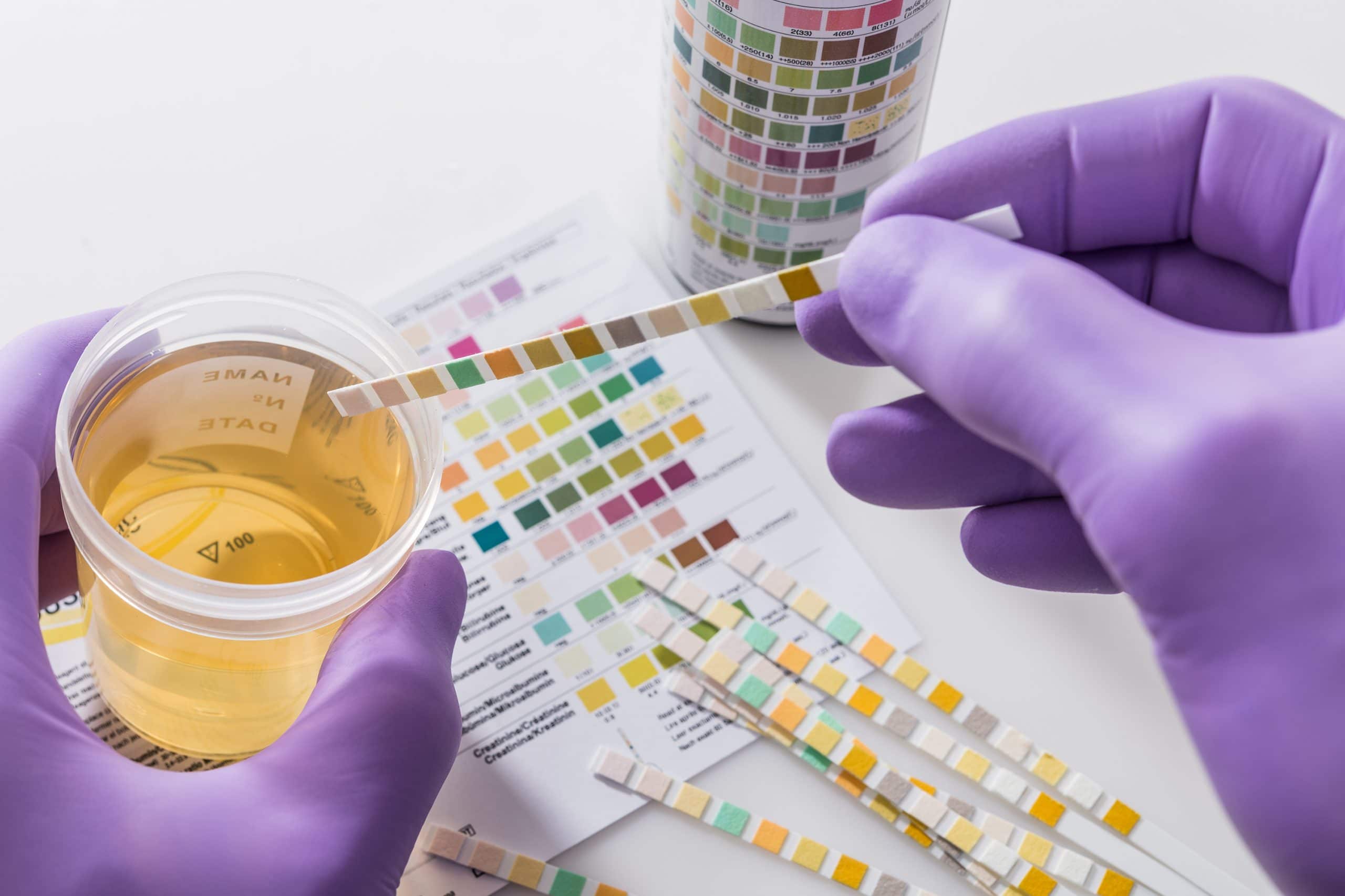How Long Do Drugs Stay in Your System? Addiction Center