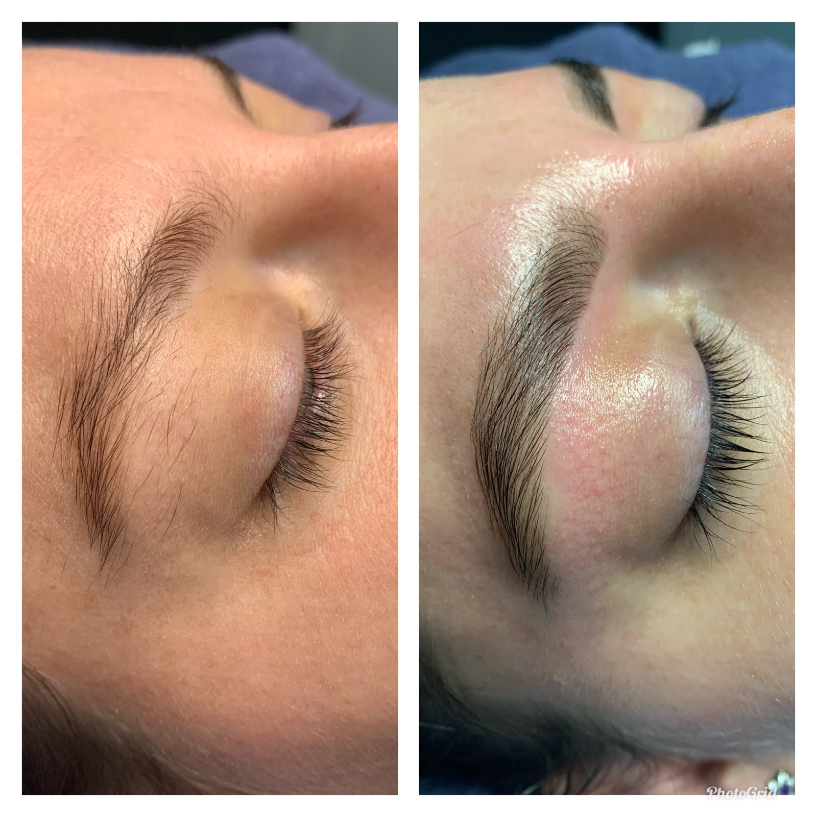 Before and After Photo, Beauty Treatments Adeva The Art of Beauty