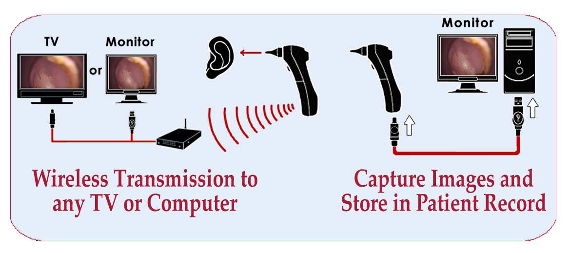Wireless Video Otoscope Advanced Monitors Corporation Medical Equip