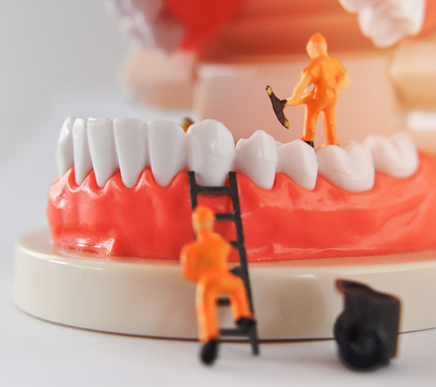 Mini Dental Implants San Antonio, TX AD Perio & Implants