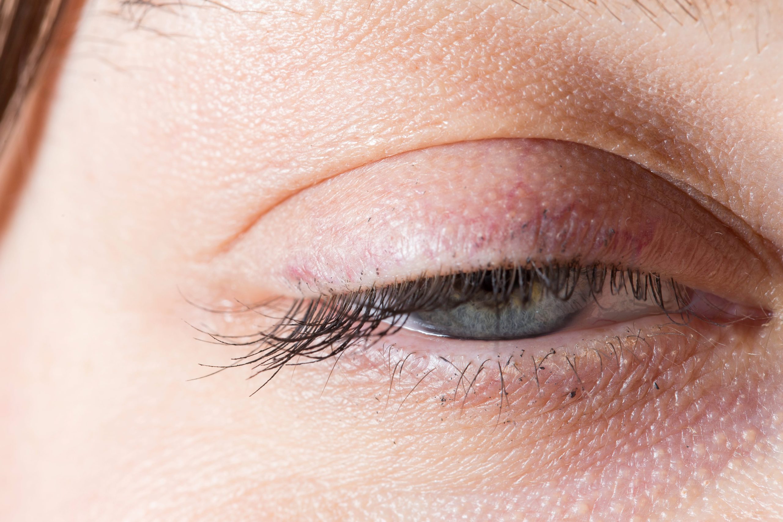 Bell’s Palsy Advanced Care Physical Therapy.