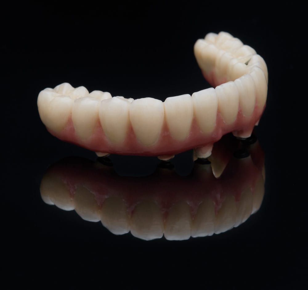 Allon4 Dental Implants Advanced Dentistry Portland Dental Implants