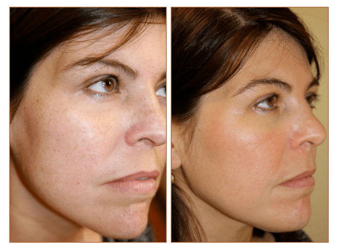 Pictures Obagi skin care Orlando, Pictures Obagi skin care Clermont