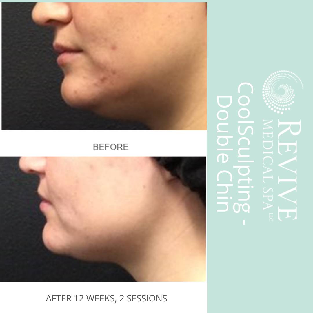 Advanced Skin Care Advanced Dermatology & Skin Cancer Center