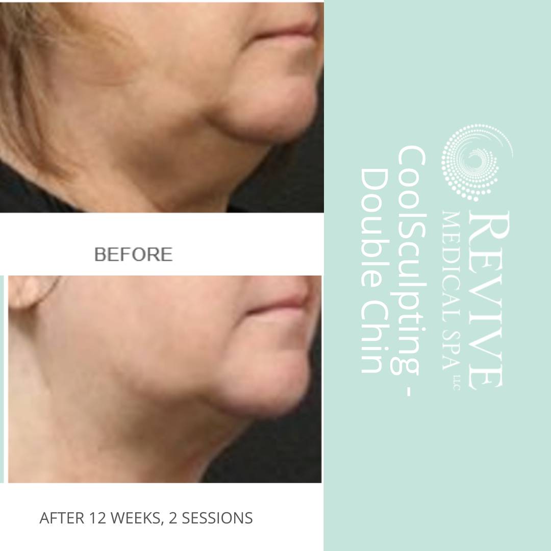 Advanced Skin Care Advanced Dermatology & Skin Cancer Center