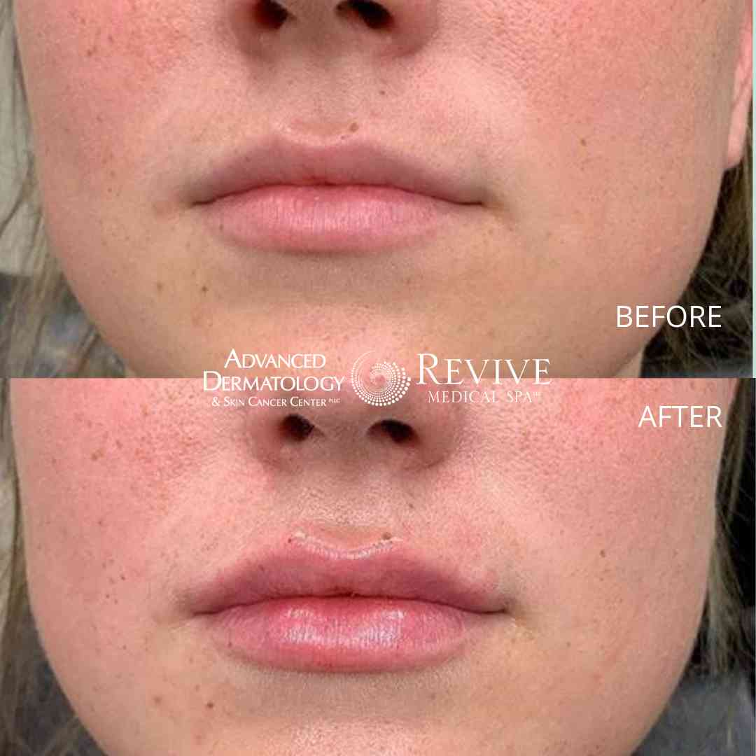 Advanced Skin Care Advanced Dermatology & Skin Cancer Center