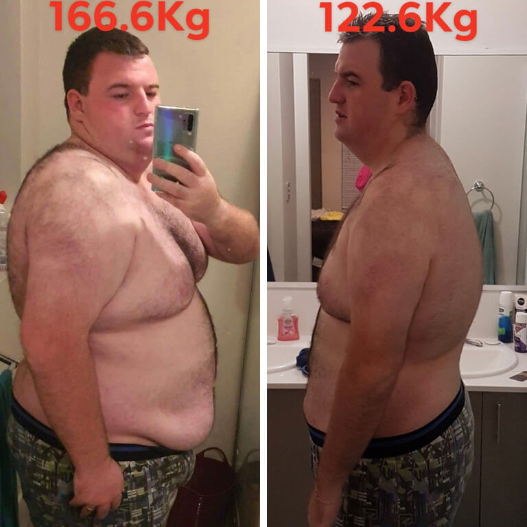 Gastric Sleeve Results