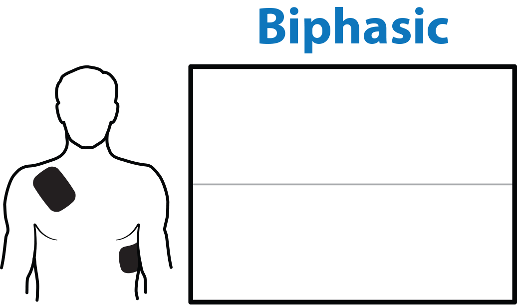 Medical Equipment Blog Monophasic and Biphasic Defibrillator, What