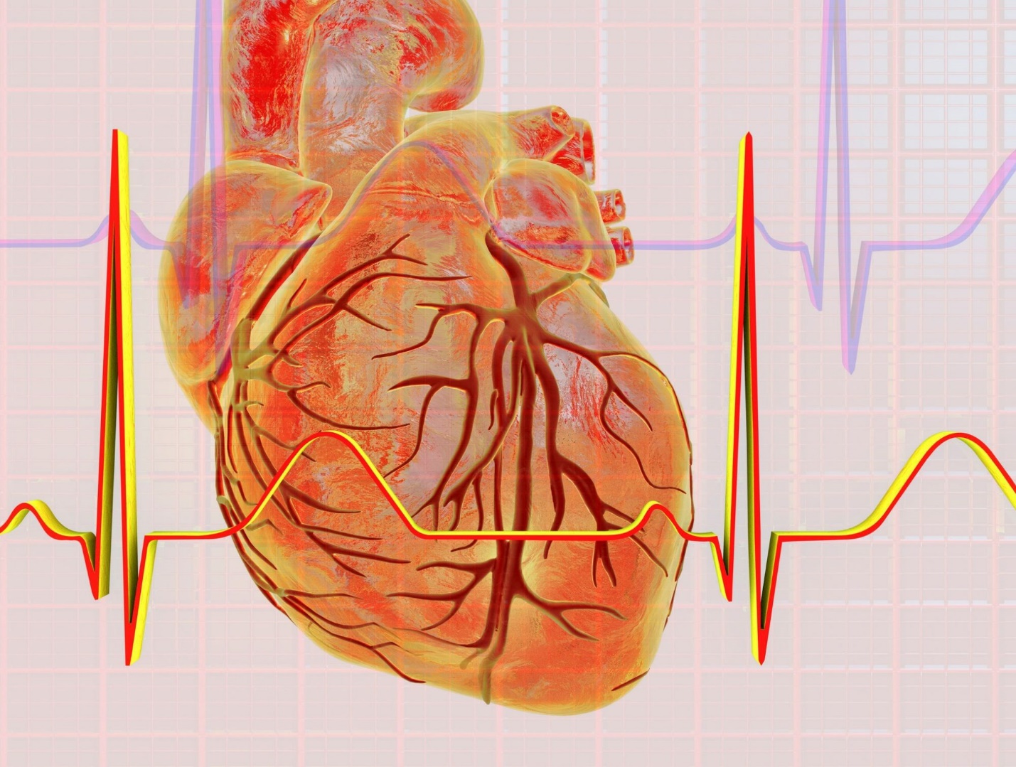 What Does A Defibrillator Look Like?