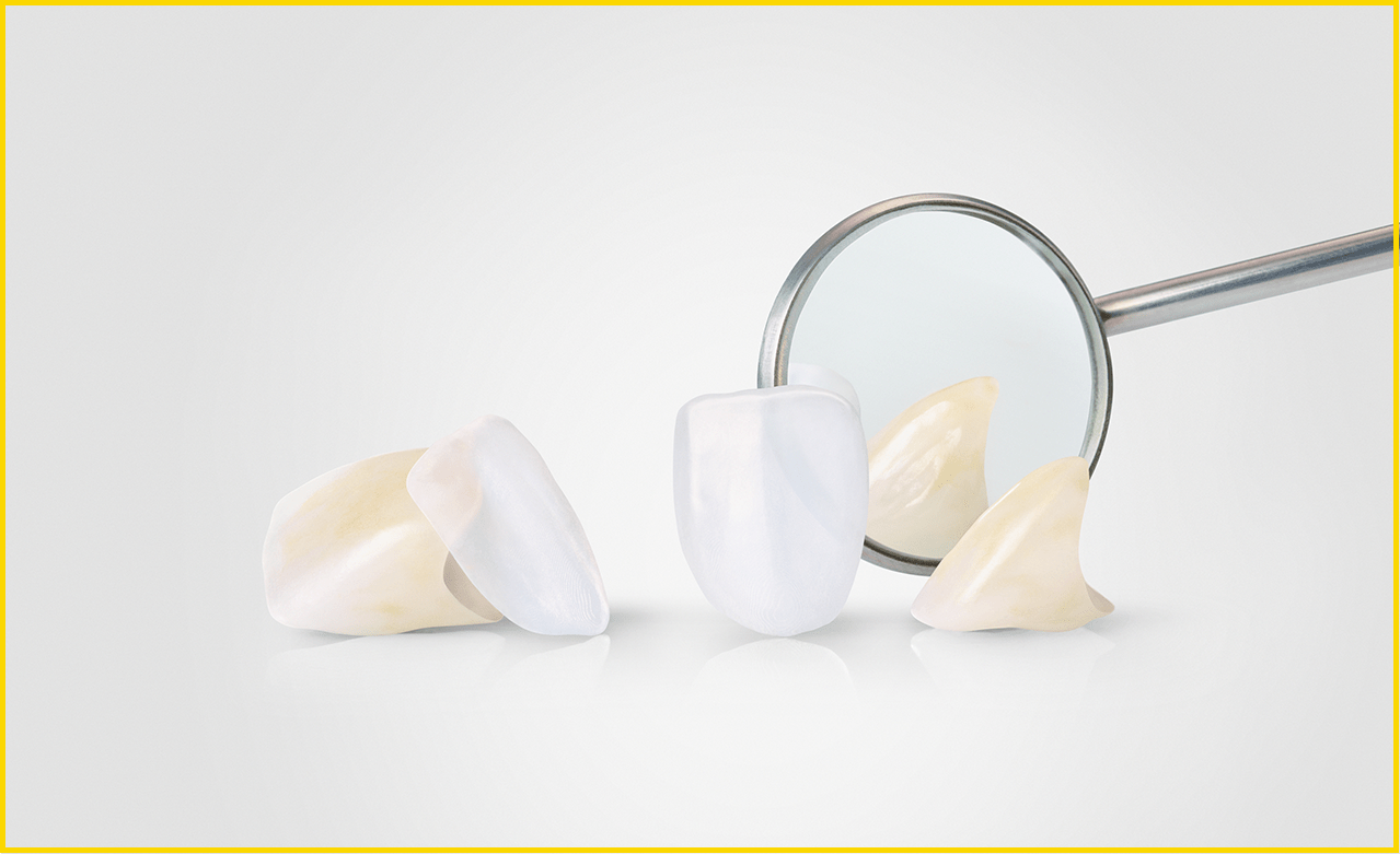 Lithoz at IDS 2023 Premiere of 3DPrinted Lithium Disilicate