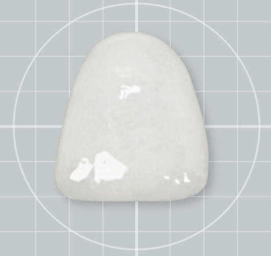 DenMat’s Cerinate Onehour™ Permanent Veneers Affordable Whitening