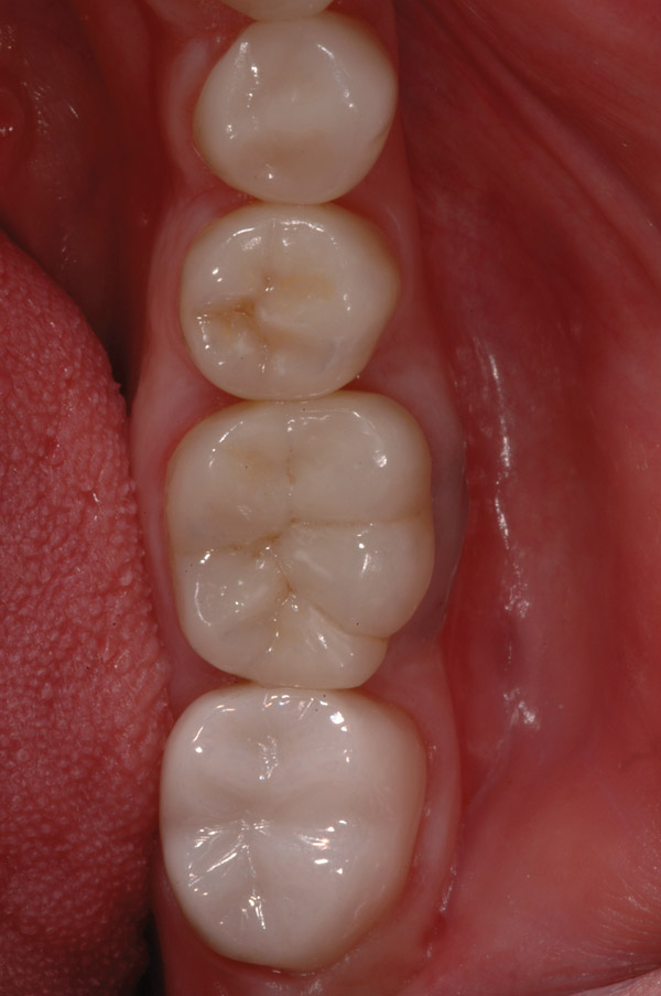 Finishing and Polishing with Modern Ceramic Systems February 2013