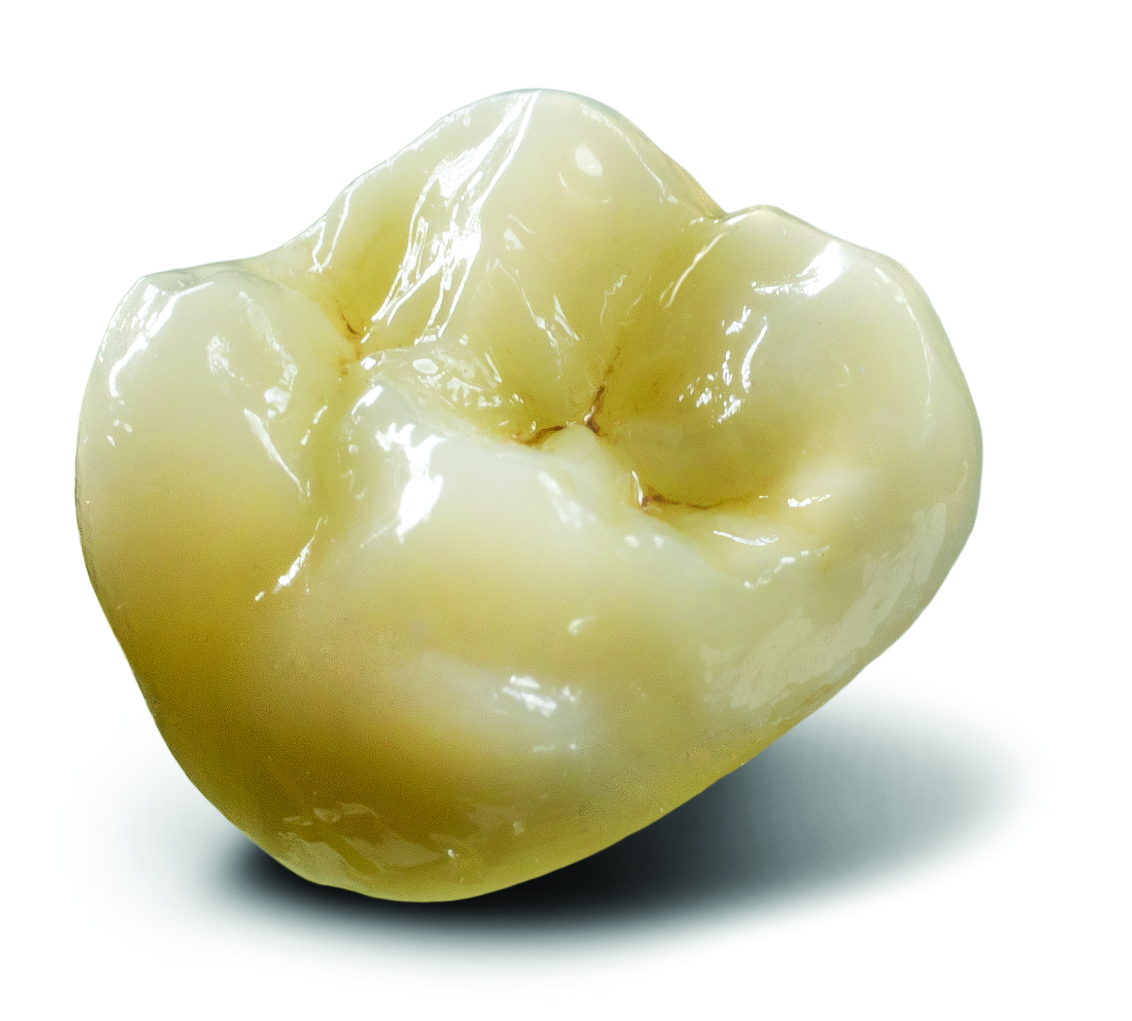 Technicians Praise Jensen Glaze Aegis Dental Network