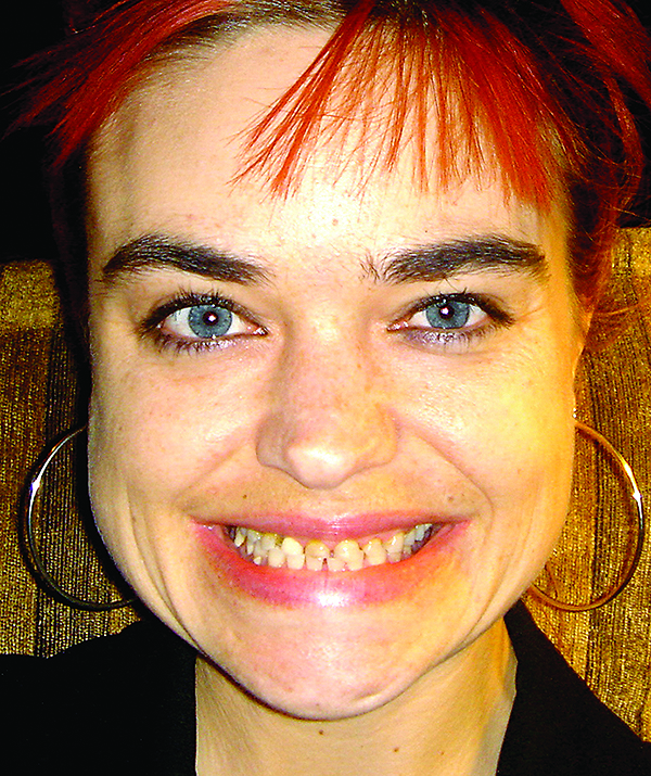 Oral Rehabilitation and Psychosocial Evaluation of a Patient with