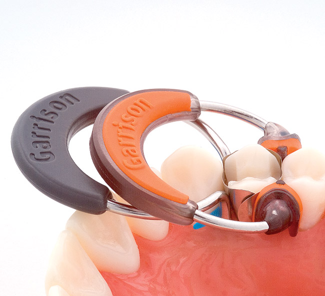 The ComposiTight 3D™ Sectional Matrix System February 2009 Inside