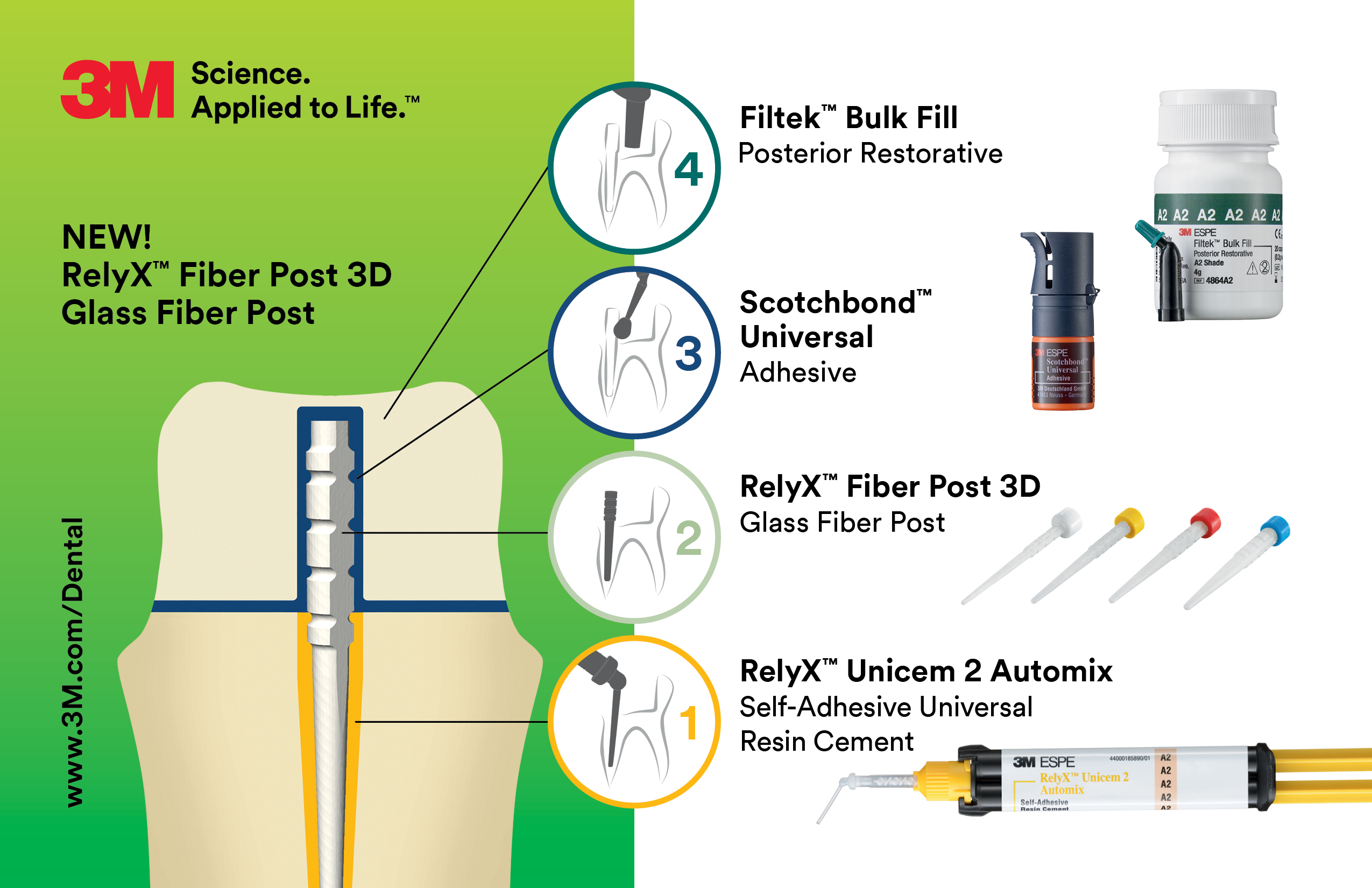 3M Oral Care Releases RelyX™ Fiber Post 3D Glass Fiber Post Aegis