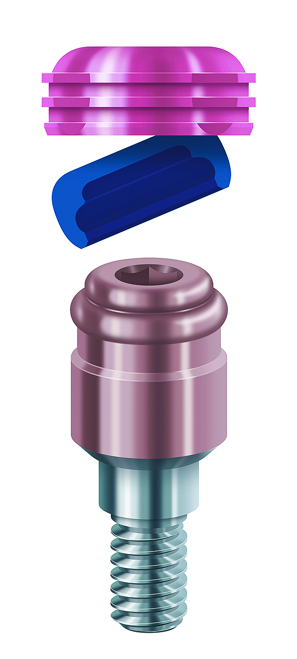 ZEST Anchors Introduces The Next Generation LOCATOR® LOCATOR RTx