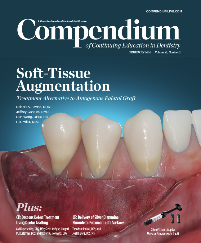 Advances in Composite Restorative Materials Support Conservative