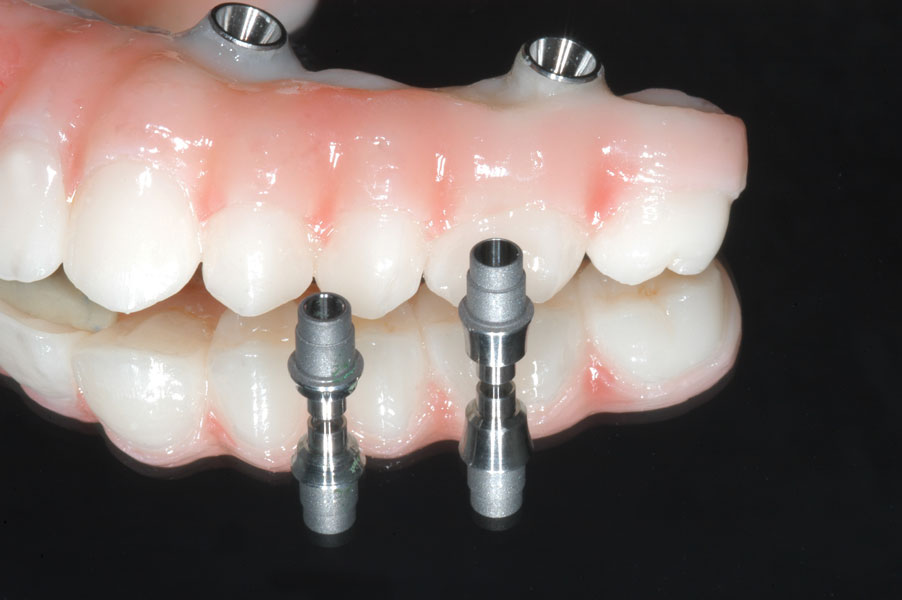 The Dental Lab 3D AOX November 2022 Inside Dentistry