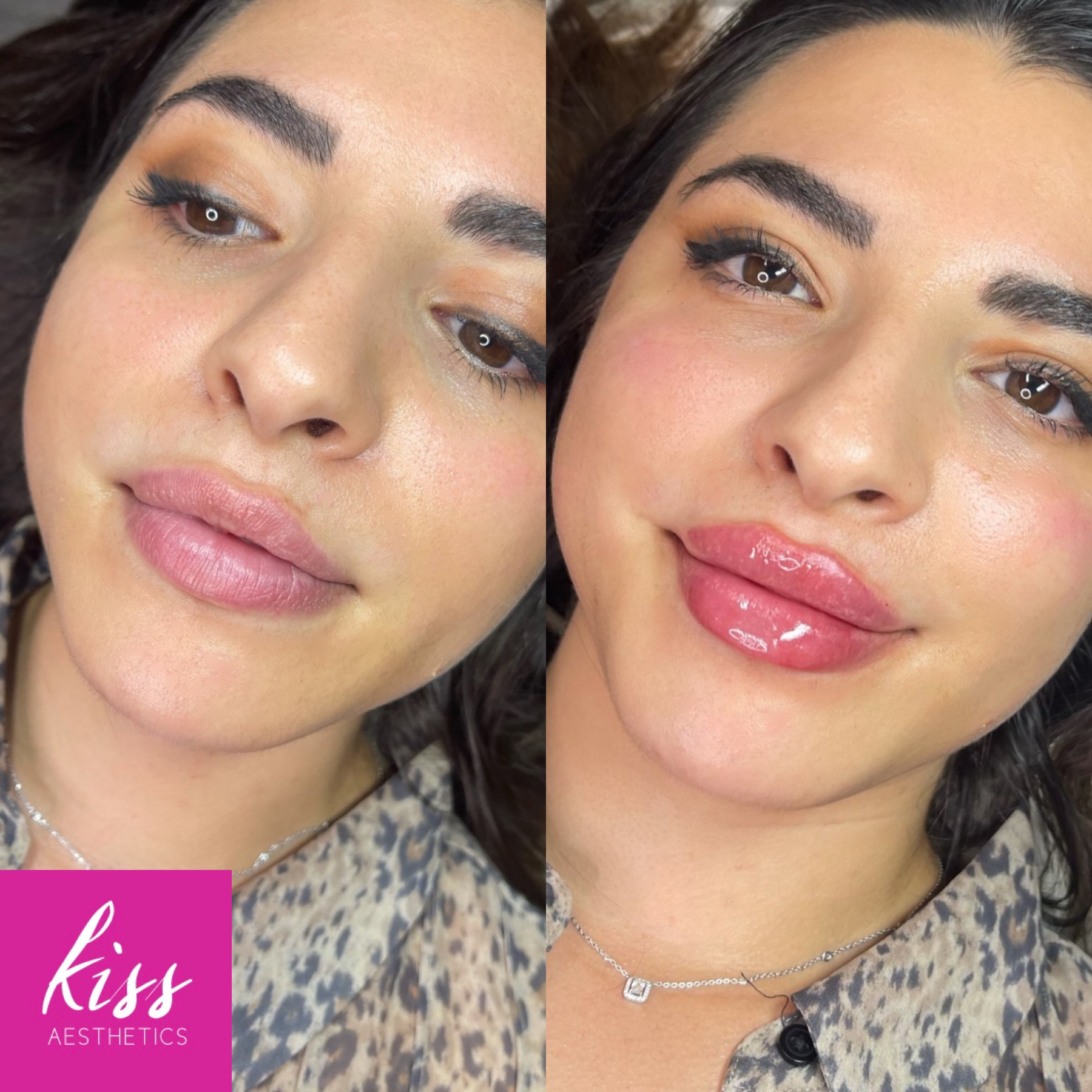 Birmingham Kiss Aesthetics