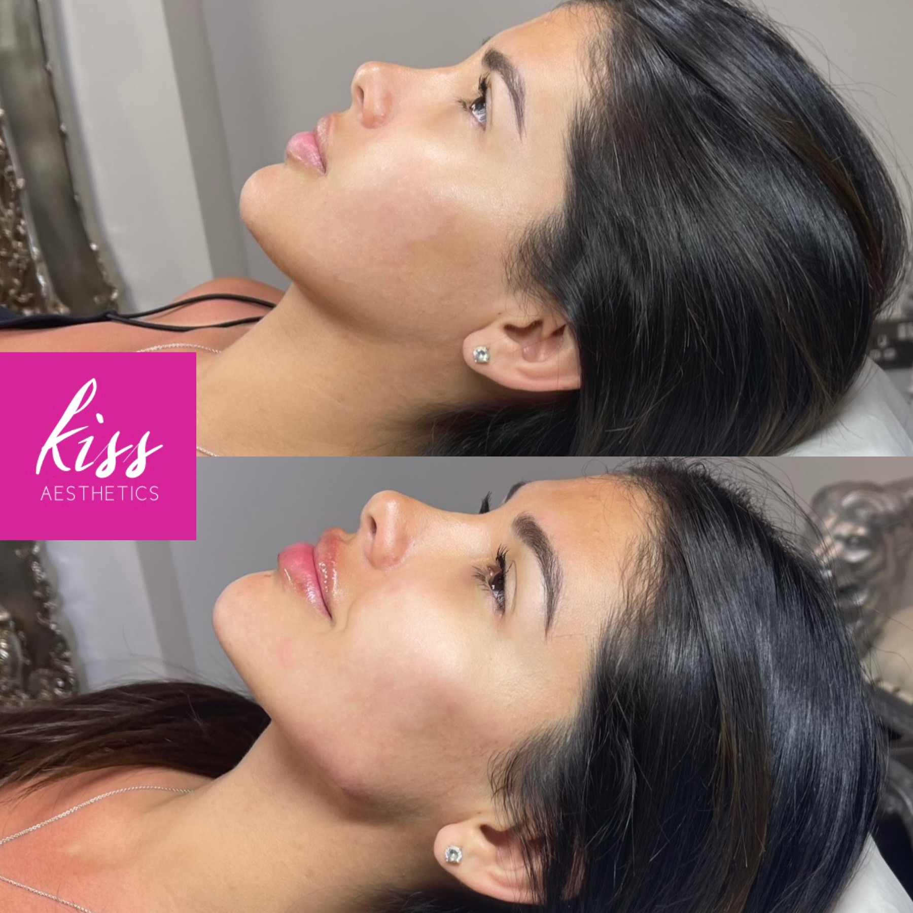 Birmingham Kiss Aesthetics