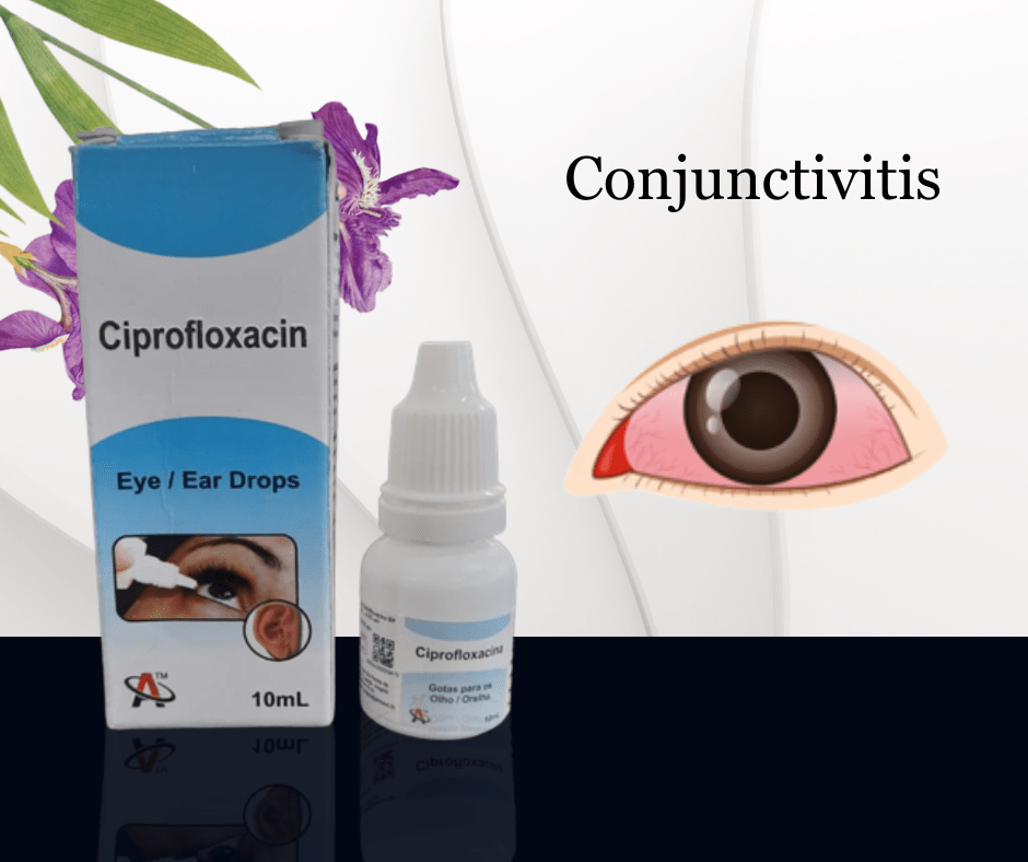 Conjunctivitis Home