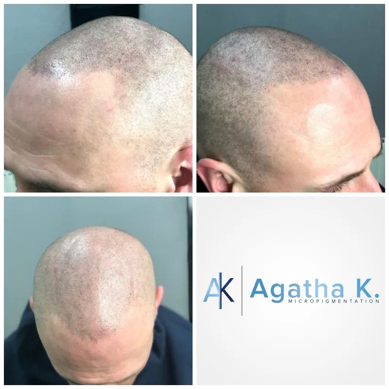 Nr.1 Hair Tattoo (SMP) Artist Amazing Results by Agatha K.