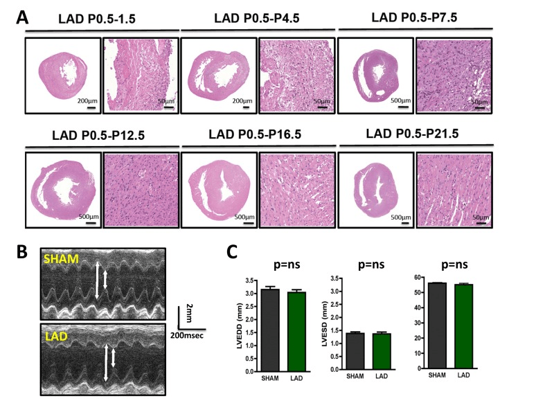 Complete cardiac regeneration in a mouse model of myocardial infarction Figure F2 Aging