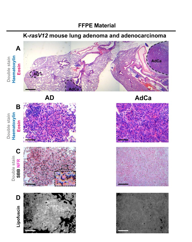 Specific lipofuscin staining as a novel biomarker to detect replicative and stressinduced